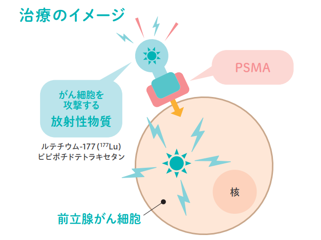治療のイメージ