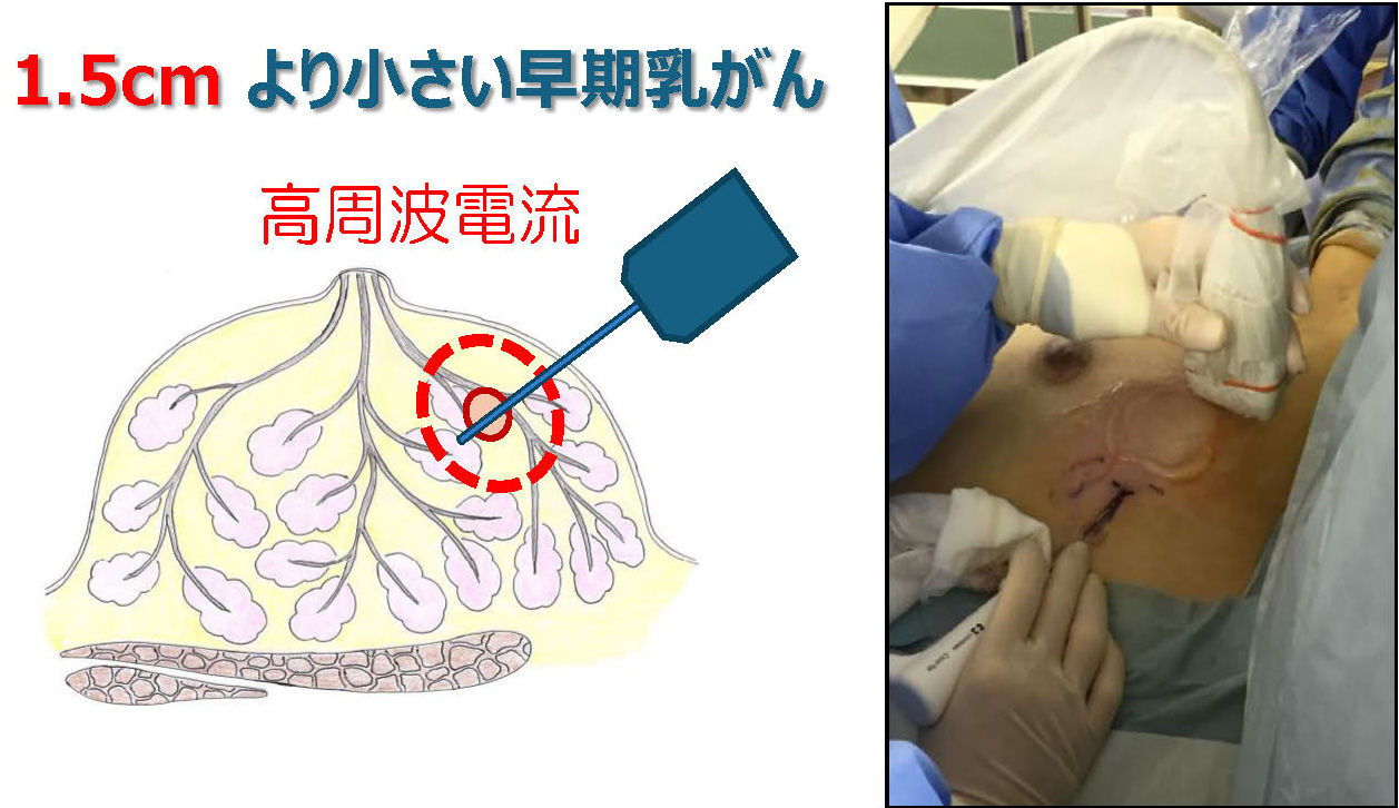 手術件数