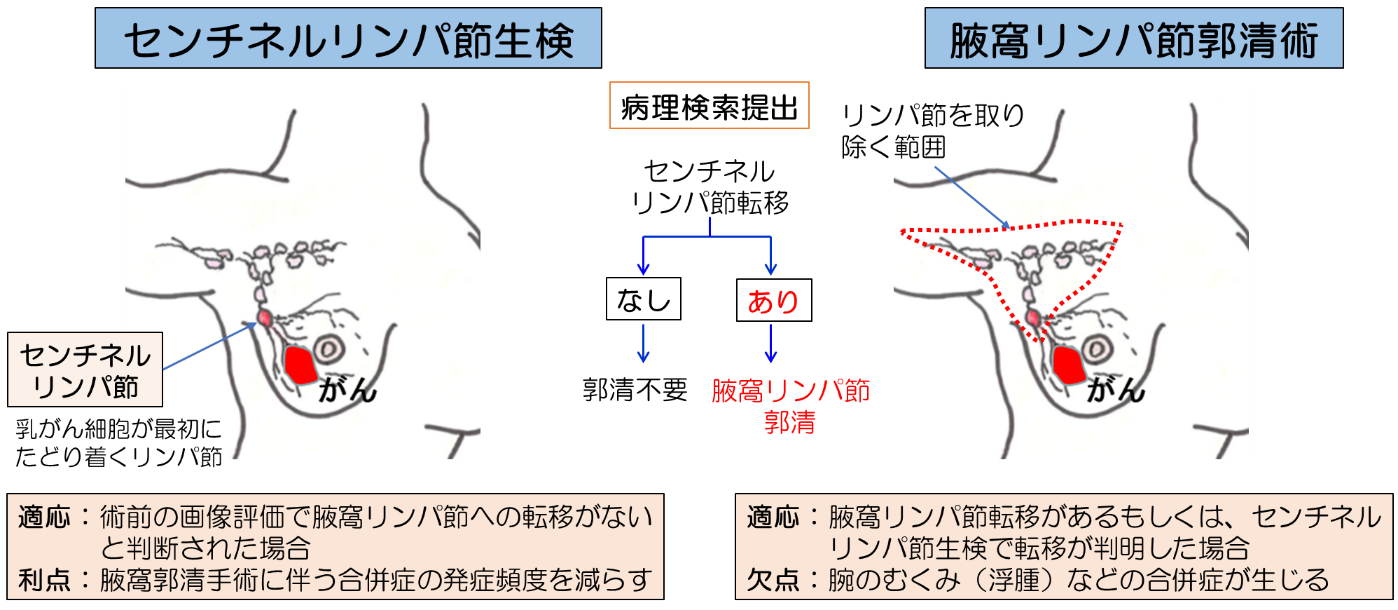 腋窩に対する手術