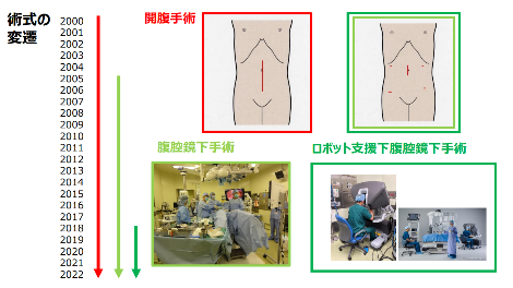 当科における腹腔鏡下手術のあゆみ