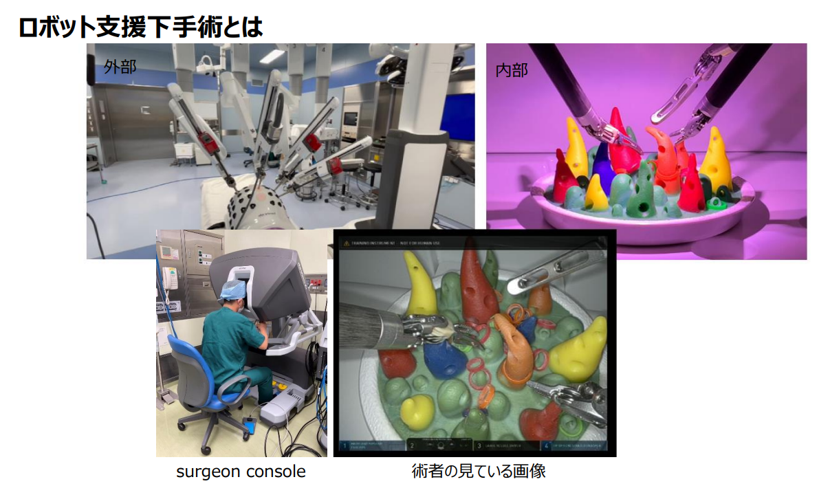 ロボット支援下手術の導入と現状
