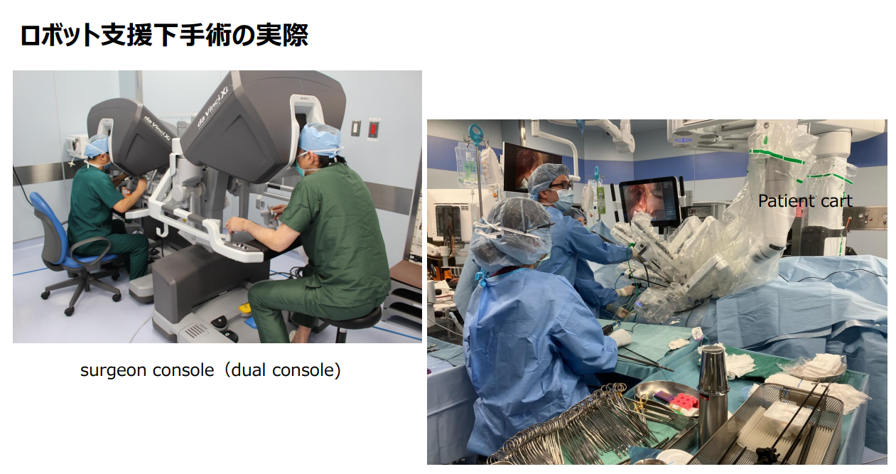 ロボット支援下手術の導入と現状