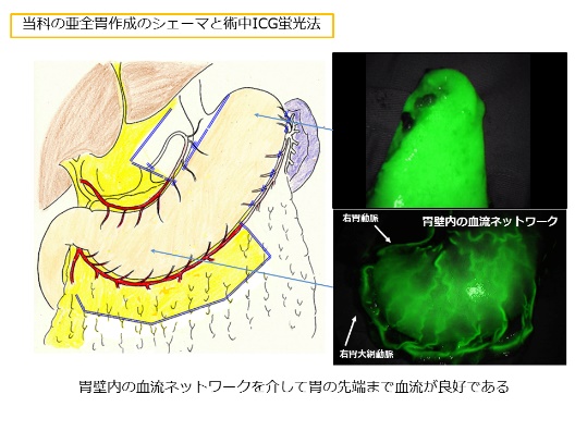 亜全胃の血流