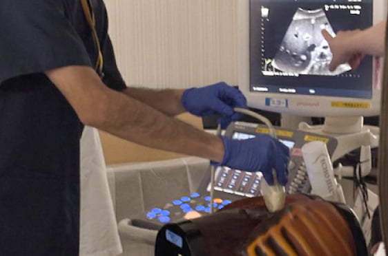 超音波診断装置