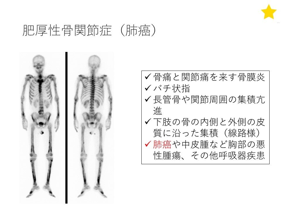 スライド例(フラッシュ核医学より）