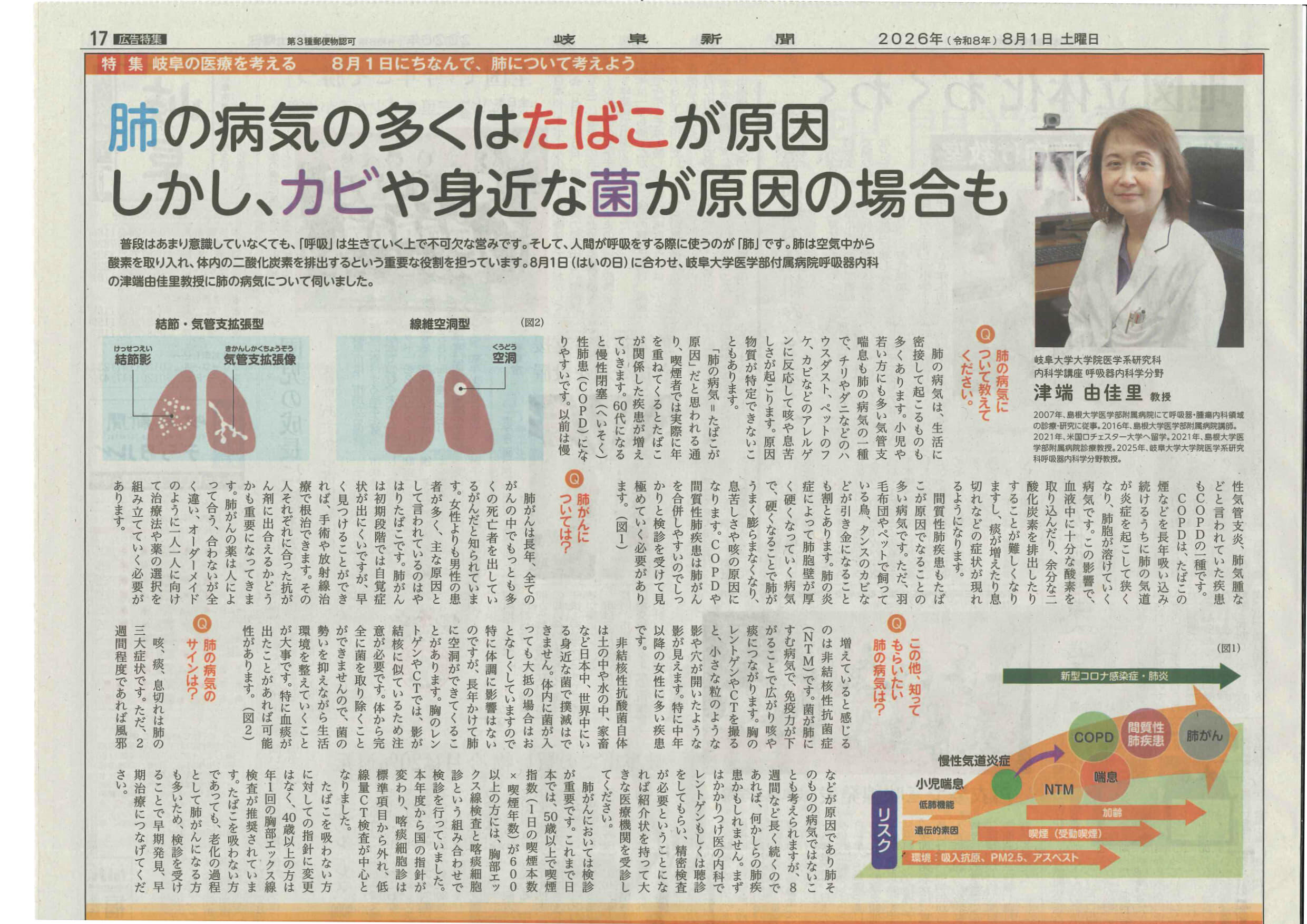 https://www.hosp.gifu-u.ac.jp/oshirase/uploads/images/20260801_Gifu_newspaper.jpg